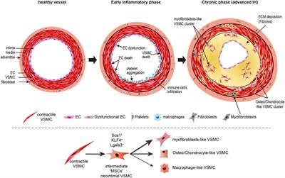 Vascular smooth muscle cells in intimal hyperplasia, an update